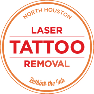North Houston Laser Tattoo Removal